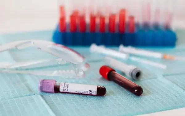 RDW Blood Test: Meaning, Normal Range, High Values, and What Your Numbers Really Say