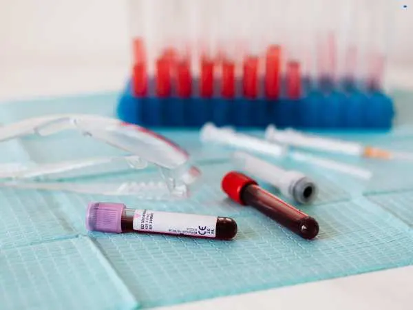 RDW Blood Test: Meaning, Normal Range, High Values, and What Your Numbers Really Say